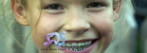 Dentistas en Chamberí Social Dental Studio Madrid brackets para ninÌos copia